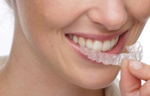Отбеливание зубов – будьте осторожны!